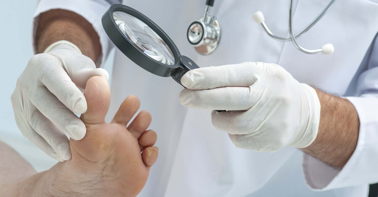 O médico examina os pés para detectar unha fungo