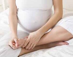 É importante que unha muller embarazada trate enfermidades fúngicas para non infectar ao bebé