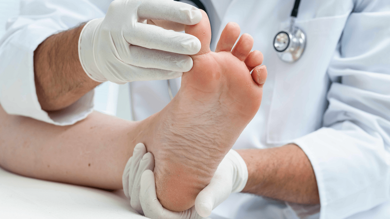 exame da pel das pernas nunha cita cun especialista