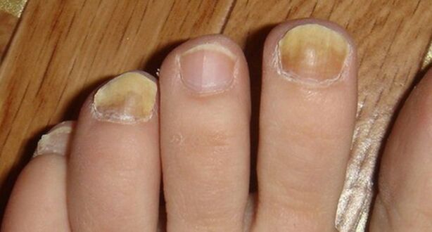 Cambiando a cor e a estrutura das uñas