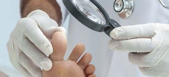 Exames antes de comezar o tratamento de fungos