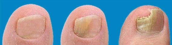 Proceso de desenvolvemento de fungos