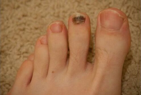 Uso de medicamentos orais e tópicos