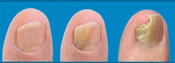 proceso de desenvolvemento de fungos