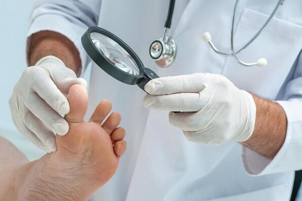 causas e tratamento de fungos nas unhas dos pés
