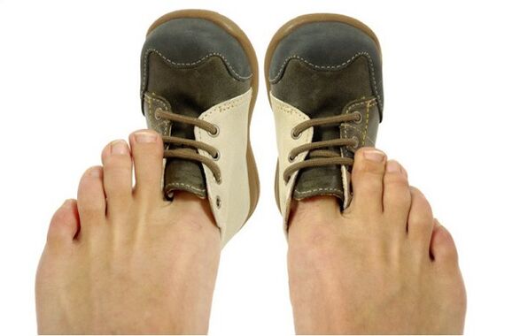 como recoñecer o fungo das unhas dos pés polos síntomas